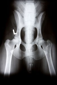 Radiology/Ultrasound